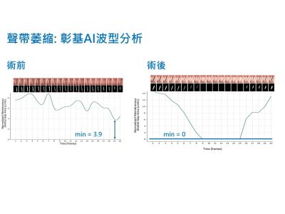 模型結果呈現
