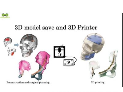 OOOPDS - 3D 醫療影像處理手術規劃軟體 (TFDA)